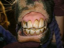 Horse Teeth Extraction 1