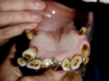 Horse Teeth Extraction 3